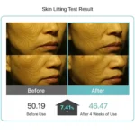 Revicia PDRN Exo Shot_ Skin Lifting Test Result shown 7.41% increased after 4 weeks of use