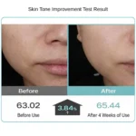 Revicia PDRN Exo Shot_ Skin Tone Improvement Test Result shows 3.84% increased after 4 weeks of use